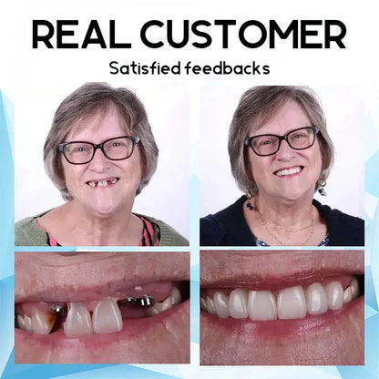 Seurico™ Premium Custom Silicone Denture Set - ✅The brand recommended by the doctor(⏰Limited time discount Last 30 minutes⏰)